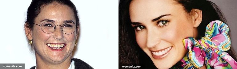 implant resim demi moore