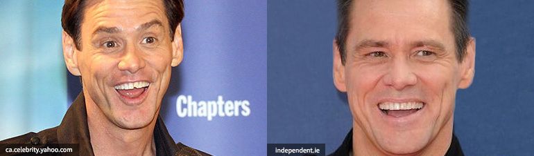 implant resim jim carrey