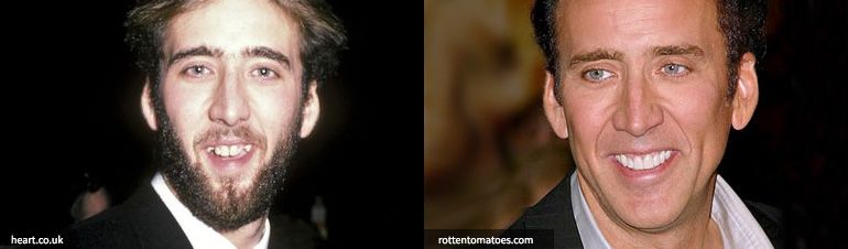 implant resim nicolas cage